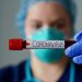 Brasil registra 10,9 mil novos casos de covid-19 em 24 horas