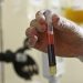 Doação de plasma sanguíneo pode ajudar no tratamento da covid-19