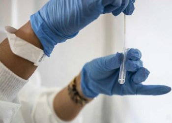 Coronavírus pode ser detectado em lágrimas, revela estudo