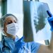 Tuberculose mata 4 mil brasileiros por ano